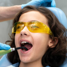 Dental Sealants: A Key to Stronger, Healthier Teeth for Kids & Adults